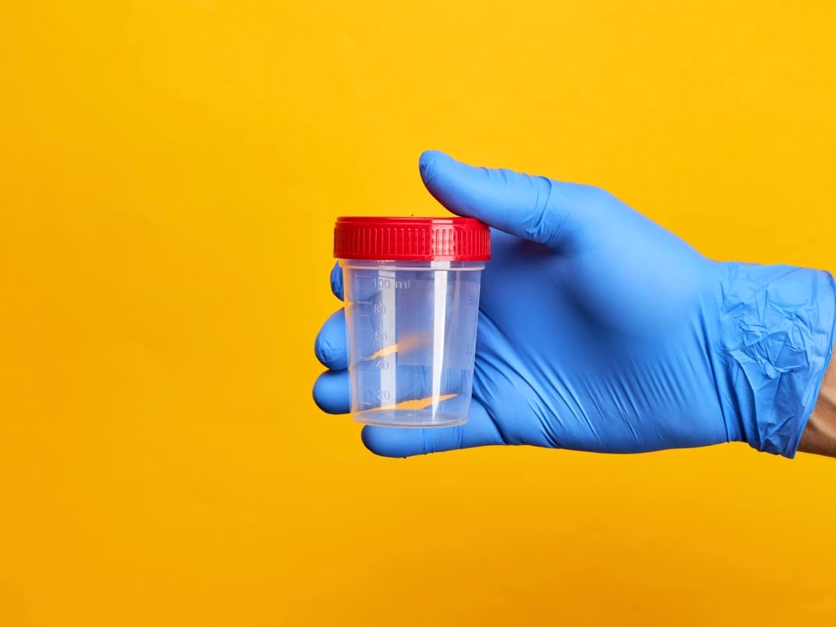 A gloved hand holding a sterile specimen container with a red lid against a yellow background